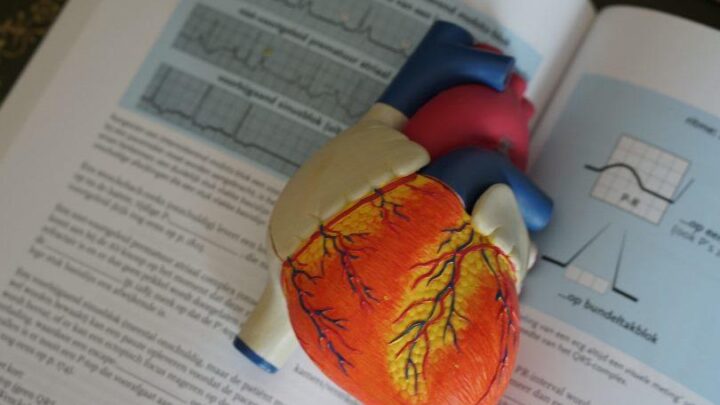 أحدث المعلومات حول اضطرابات نظم القلب الأذيني برأي طبيب