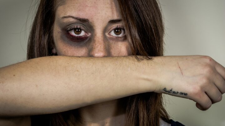 هل العنف ضدّ النساء مرض مستوطن في العالم؟ | مرأة