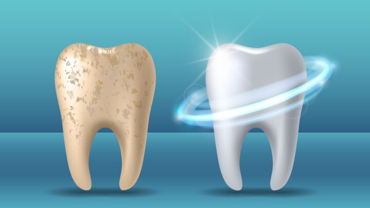 كيف يمكن تقوية مينا الاسنان طبيعيا؟ – موقع علوم العرب