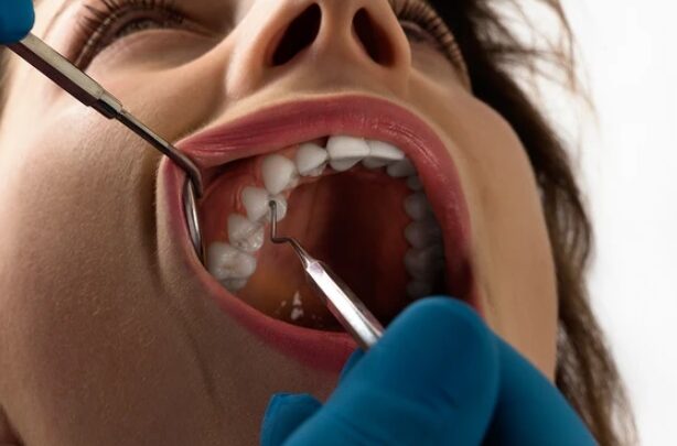 امرأة تقاضي طبيب أسنان بعدما أجرى لها 32 عملية في زيارة واحدة فقط